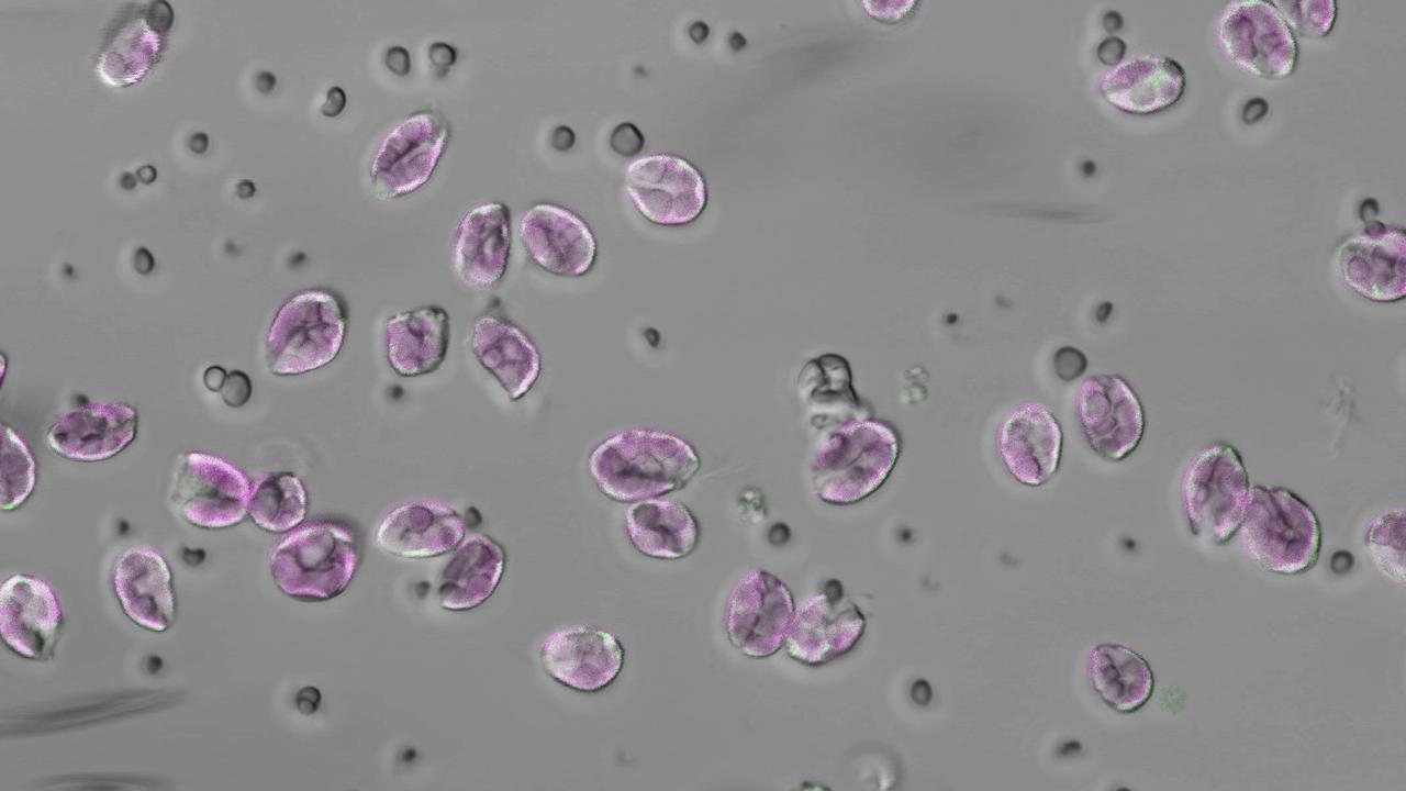 En bild från ett mikroskop med runda, lila figurer och mindre grå.