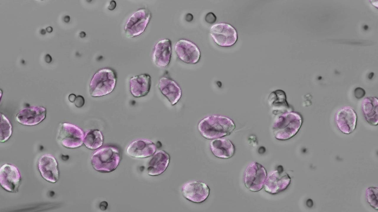En bild från ett mikroskop med runda, lila figurer och mindre grå.