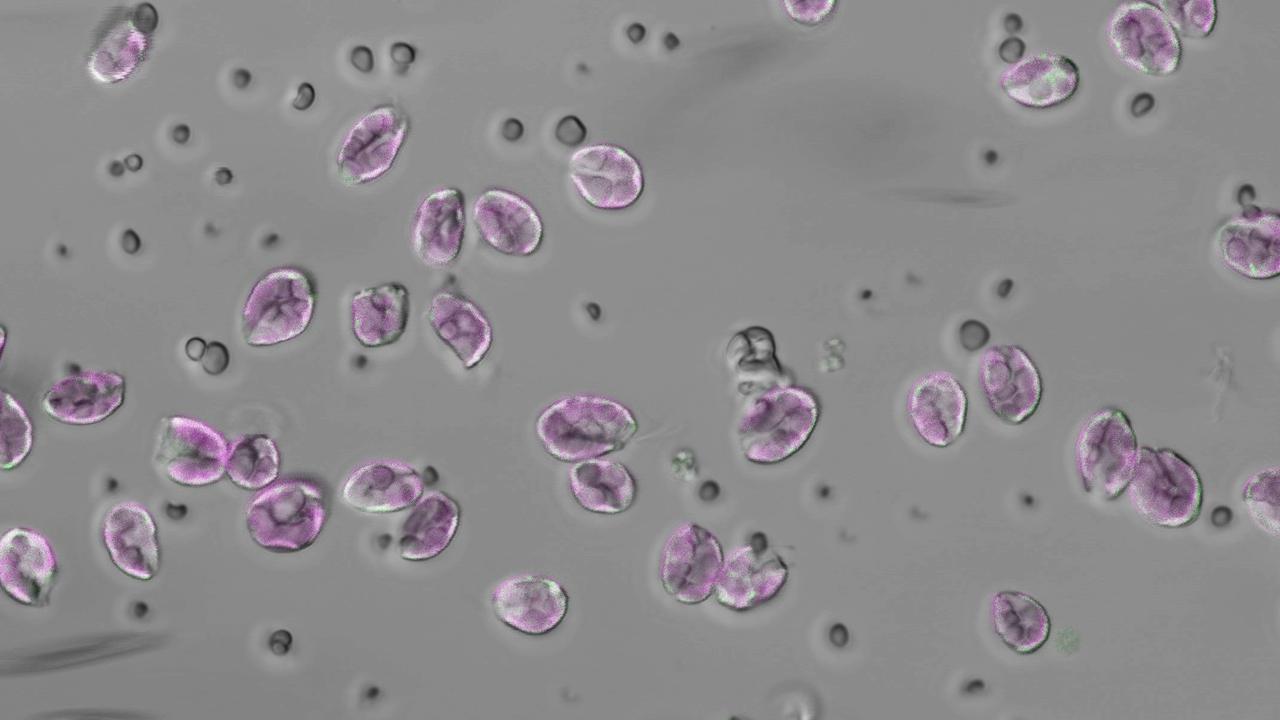 En bild från ett mikroskop med runda, lila figurer och mindre grå.