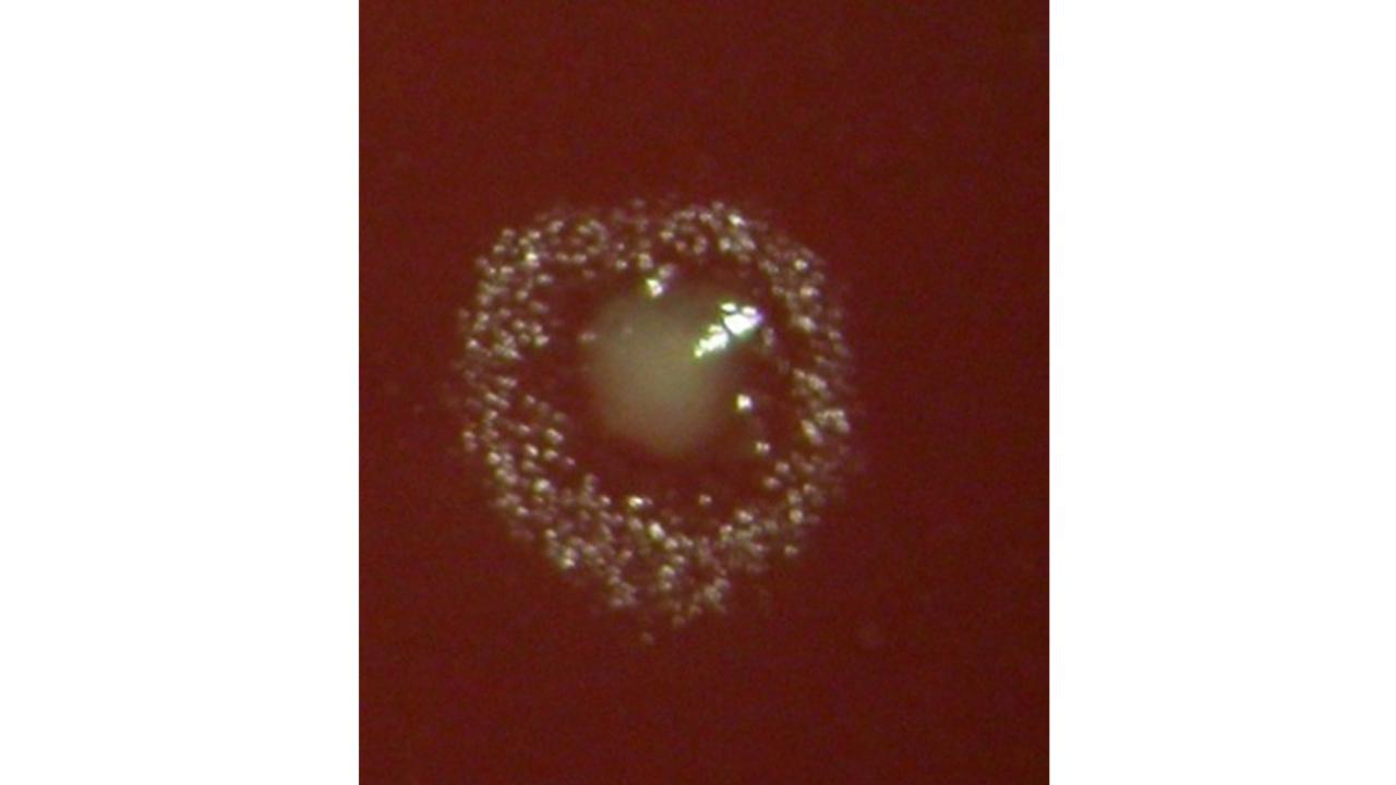 Filifactor alocis må vara en oral patogen, men den ser snäll ut vid odling