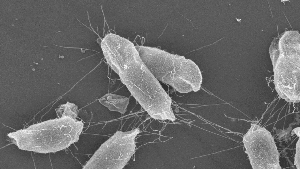 En mikroskopbild på bakterier