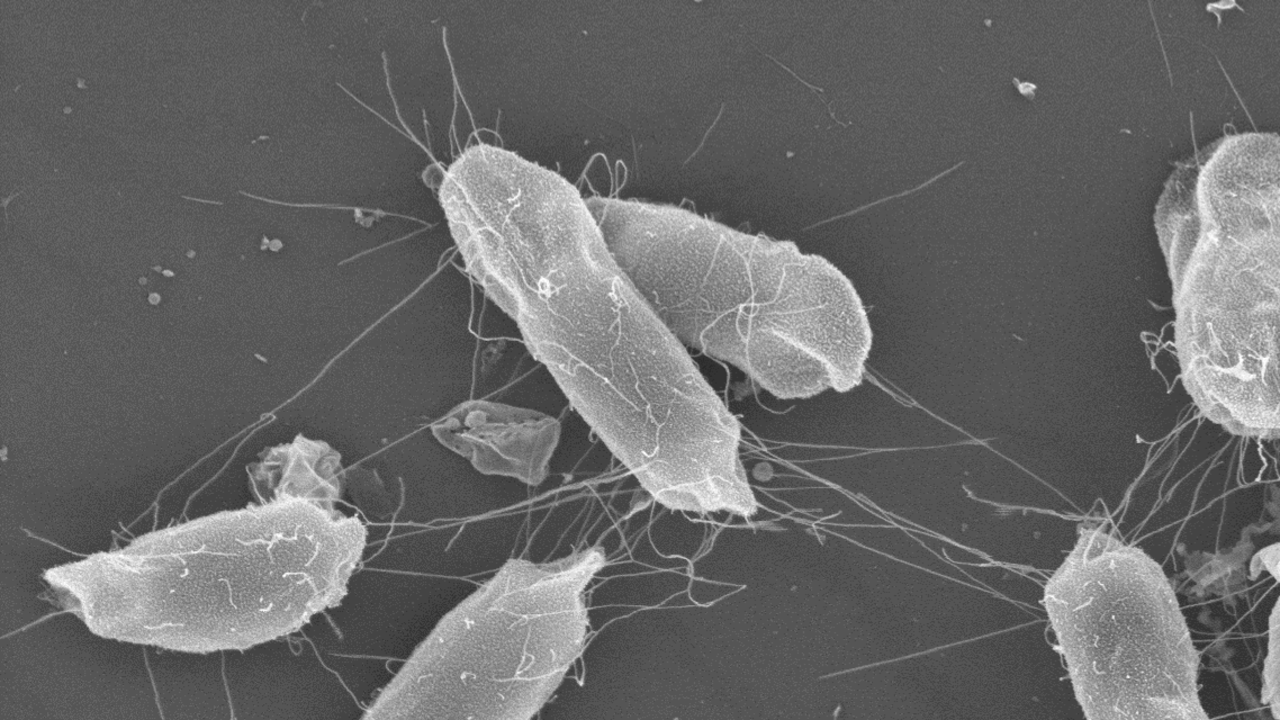 En mikroskopbild på bakterier