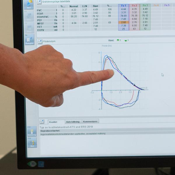 En hand som pekar på en graf på en datorskärm.