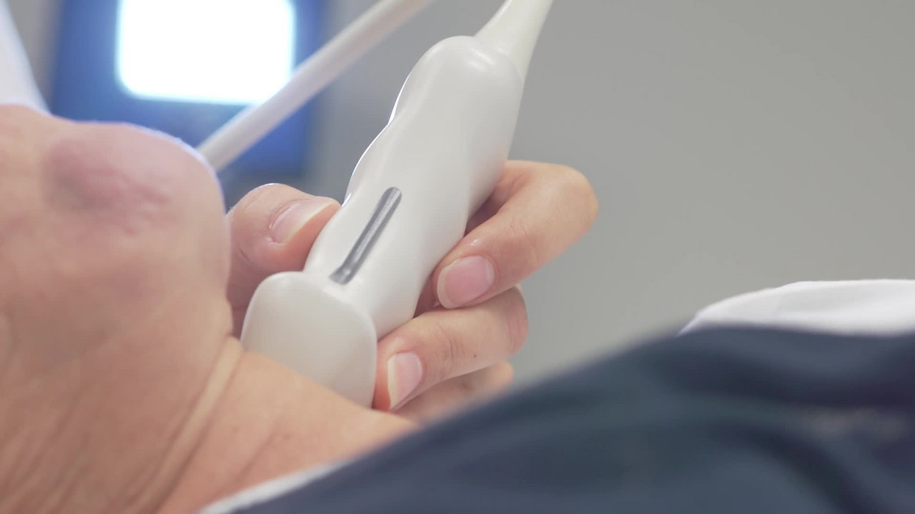 Film: VIPVIZA - Västerbotten Intervention Programme Visualization of Atherosclerosis