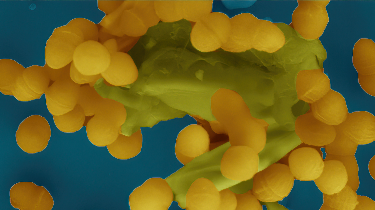 Elektronmikroskopbild på gula prickar på blå botten