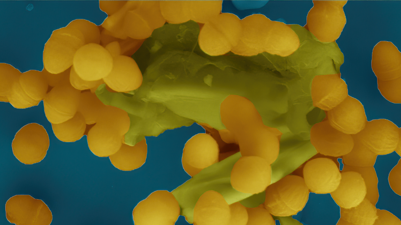 Elektronmikroskopbild på gula prickar på blå botten