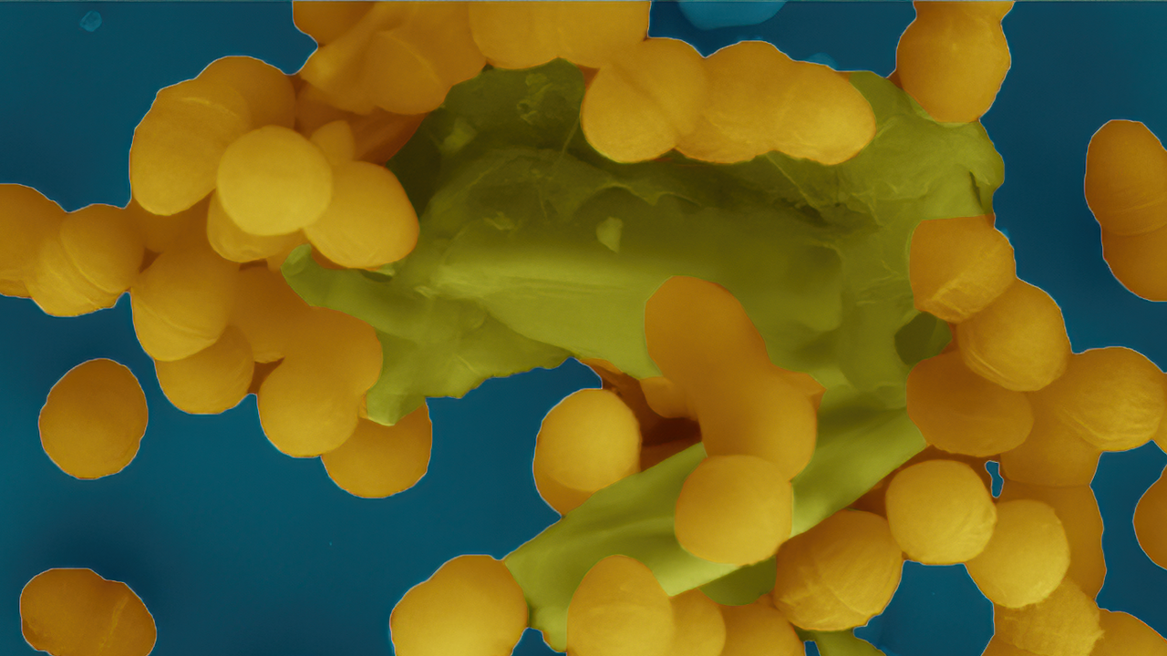 Elektronmikroskopbild på gula prickar på blå botten