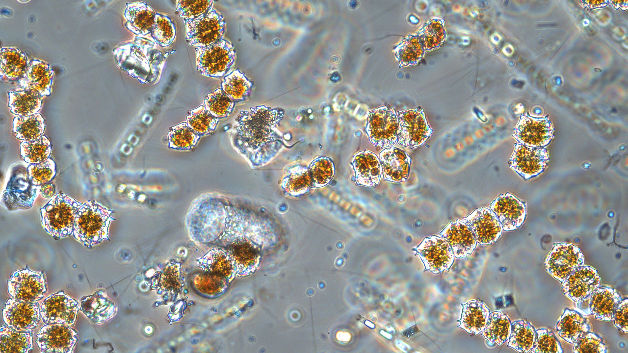 Mikroskopbild på växtplankton från Örefjärden, Västerbottens län