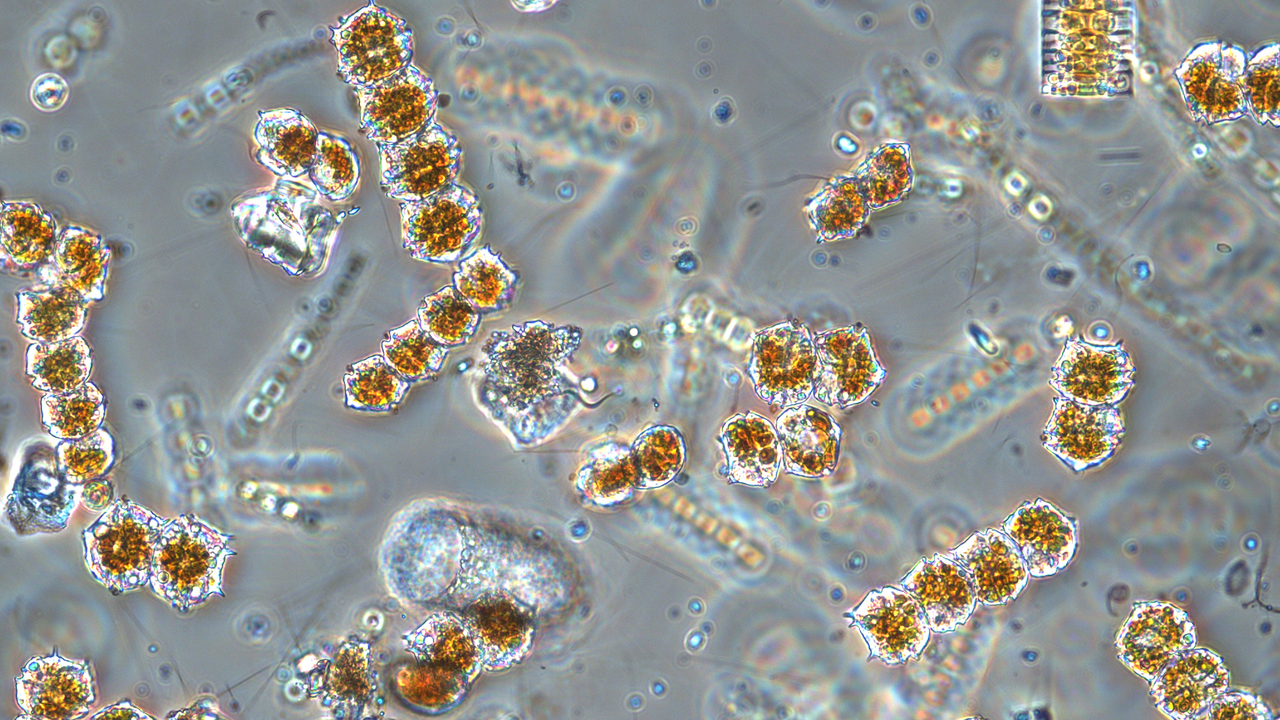 Mikroskopbild på växtplankton