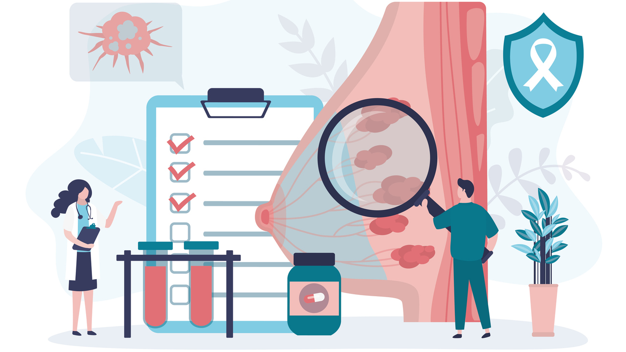 Biomarkörer för bröstcancer