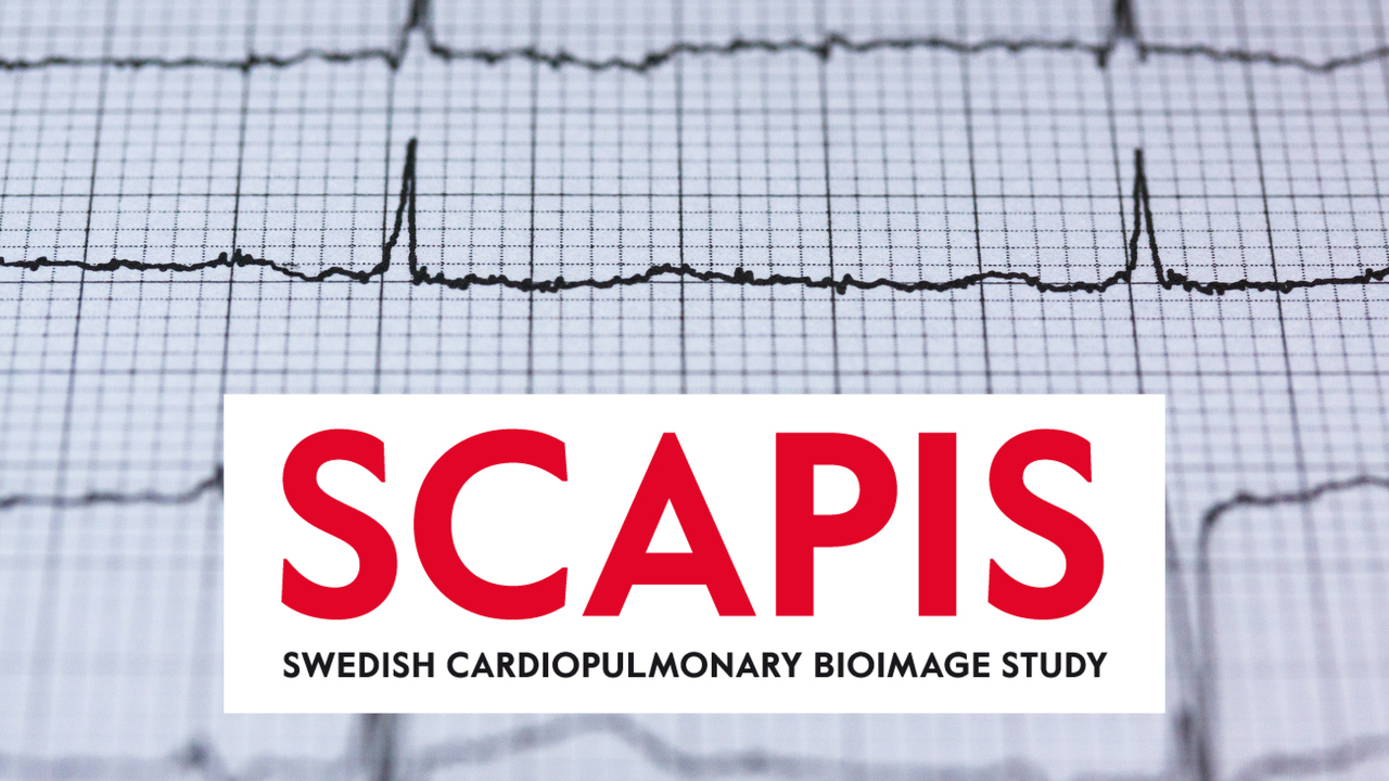 Frekvensbild av ekg med SCAPIS logotyp i förgrunden
