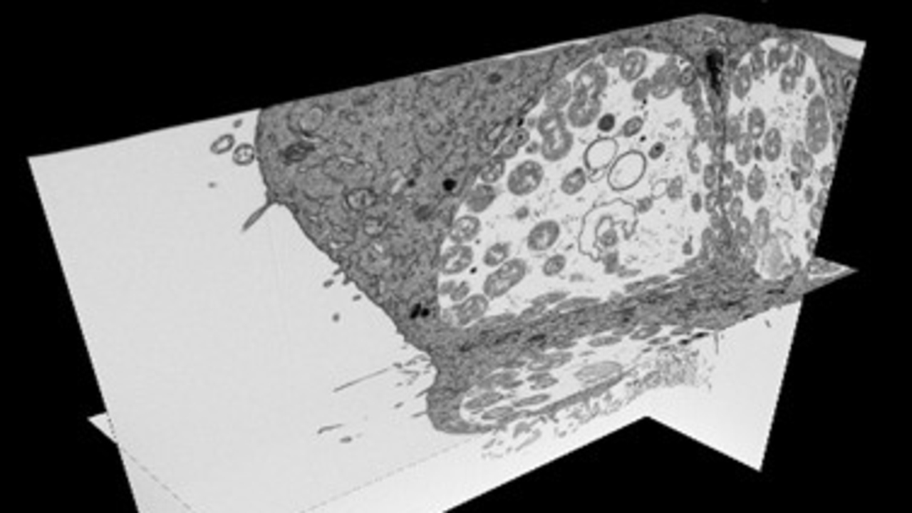 Chlamydia infected cell imaged with FIB-SEM