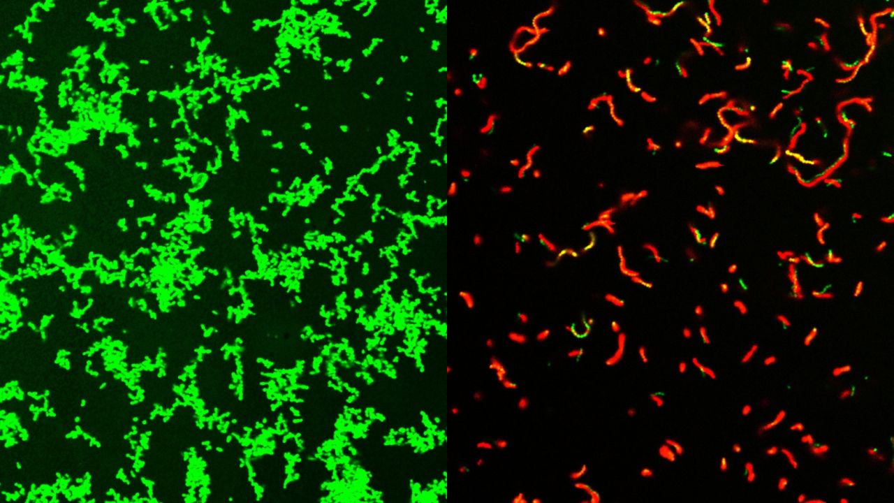 Tvådelad bild tagen i mikroskop. Till vänster gröna prickar mot svart bakgrund, till höger färre röda prickar mot svart bakgrund.