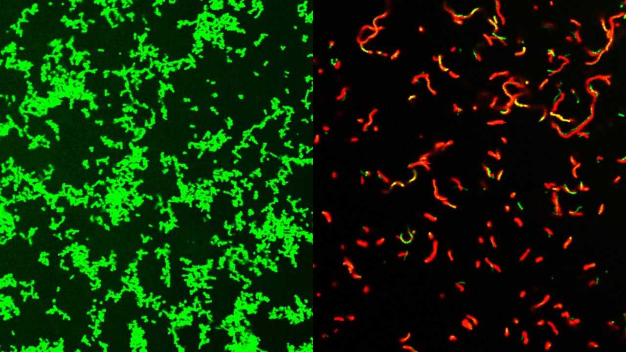 Tvådelad bild tagen i mikroskop. Till vänster gröna prickar mot svart bakgrund, till höger färre röda prickar mot svart bakgrund.