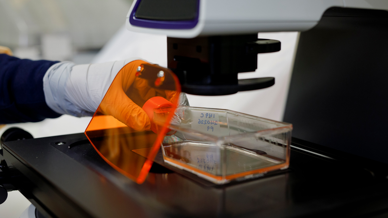 Close-up of a cell culture flask being placed under a digital light microscope.