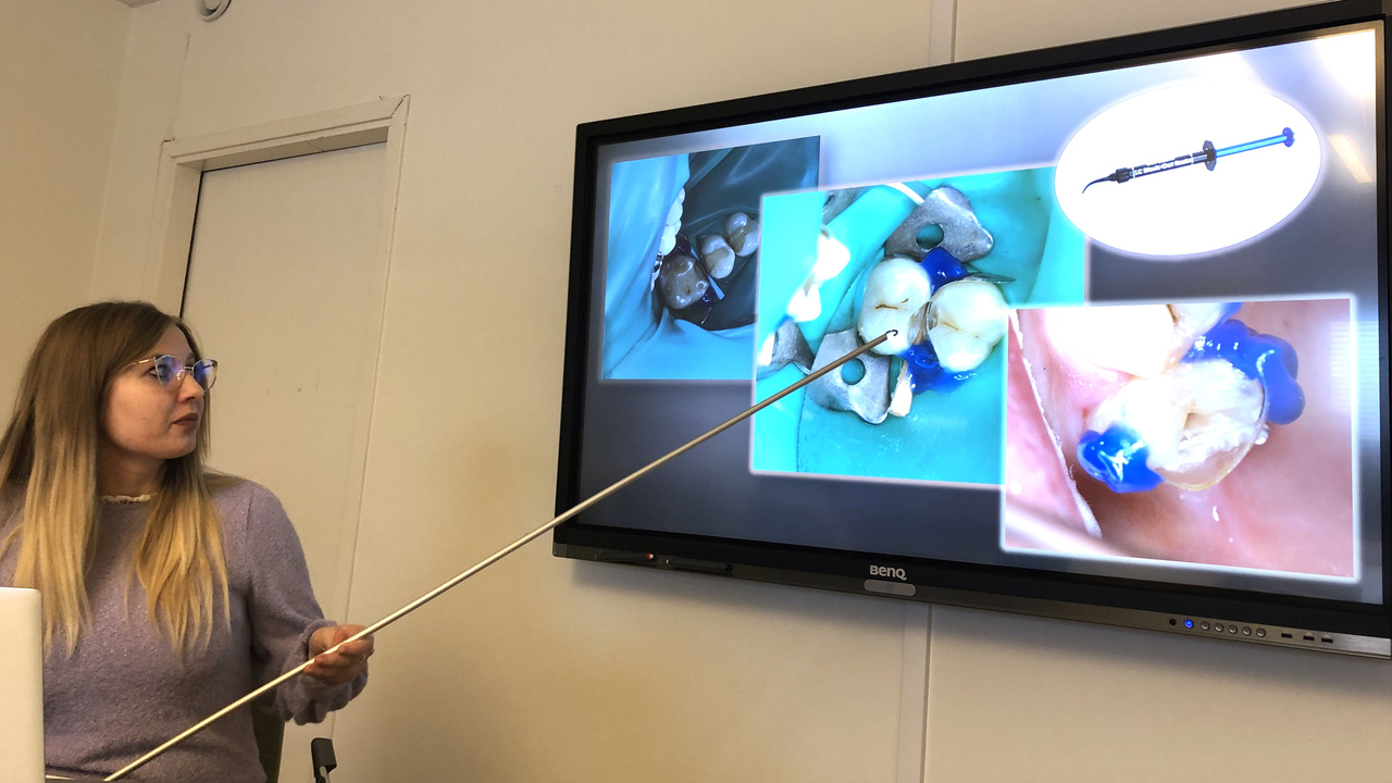 Dr Victoriia Ababii, Odontology, Periodontology and Oral Pathology, State University of Medicine and Pharmacy, Republic of Moldova lecturing in restorative dentistry, within Erasmus + mobility to the Department Odontology.