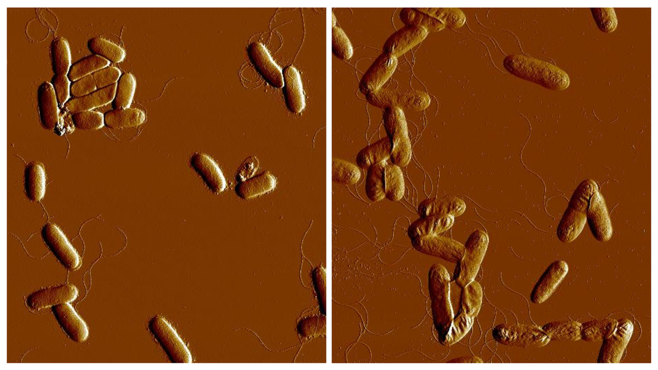 Microscopy images of Yersinia pseudotuberculosis