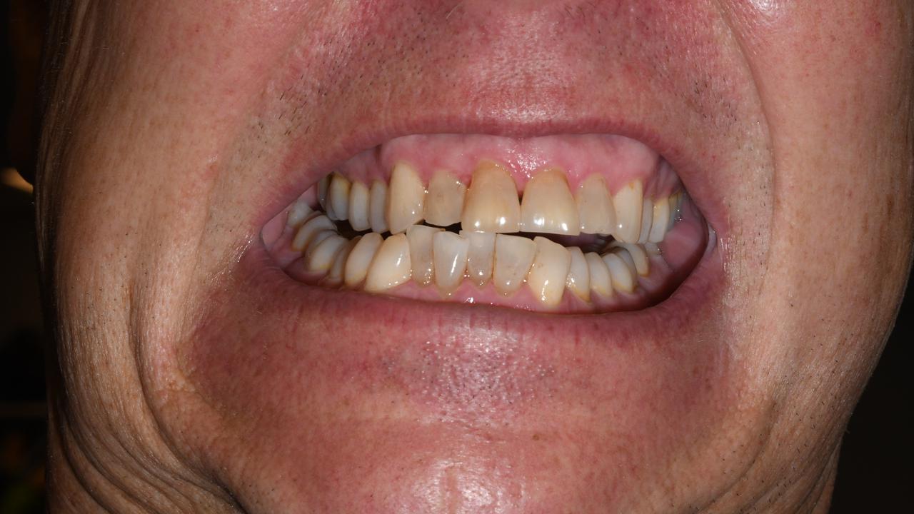 En närbild av en mun.