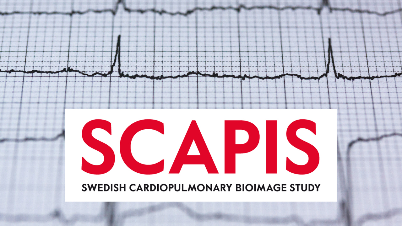 Frekvenskurva ekg med SCAPIS logotyp i förgrunden.