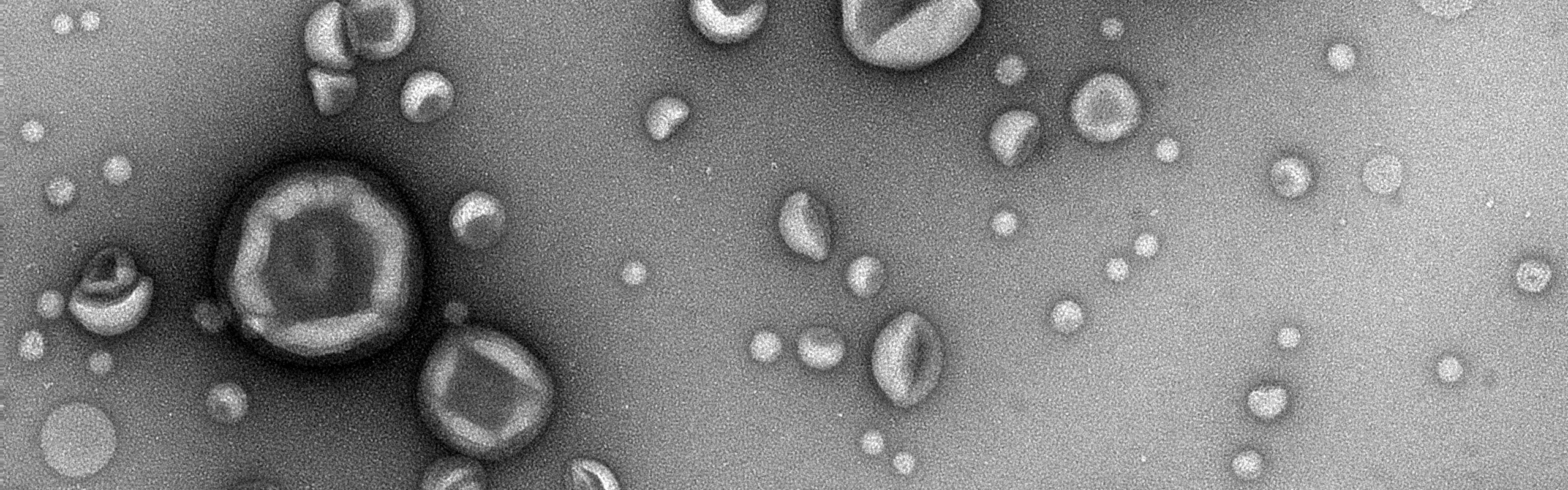 extracellulär vesikel