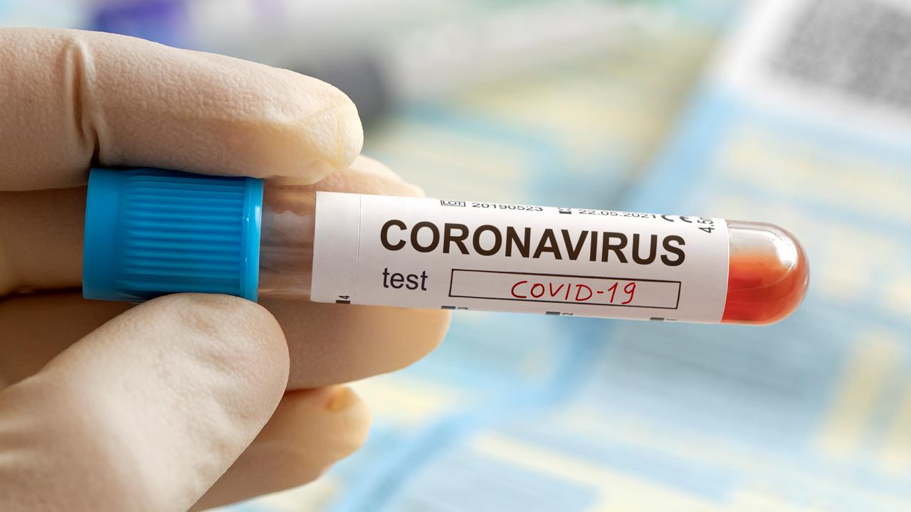 Sjuksköterskas hand som håller ett blodprov som test för coronavirus.