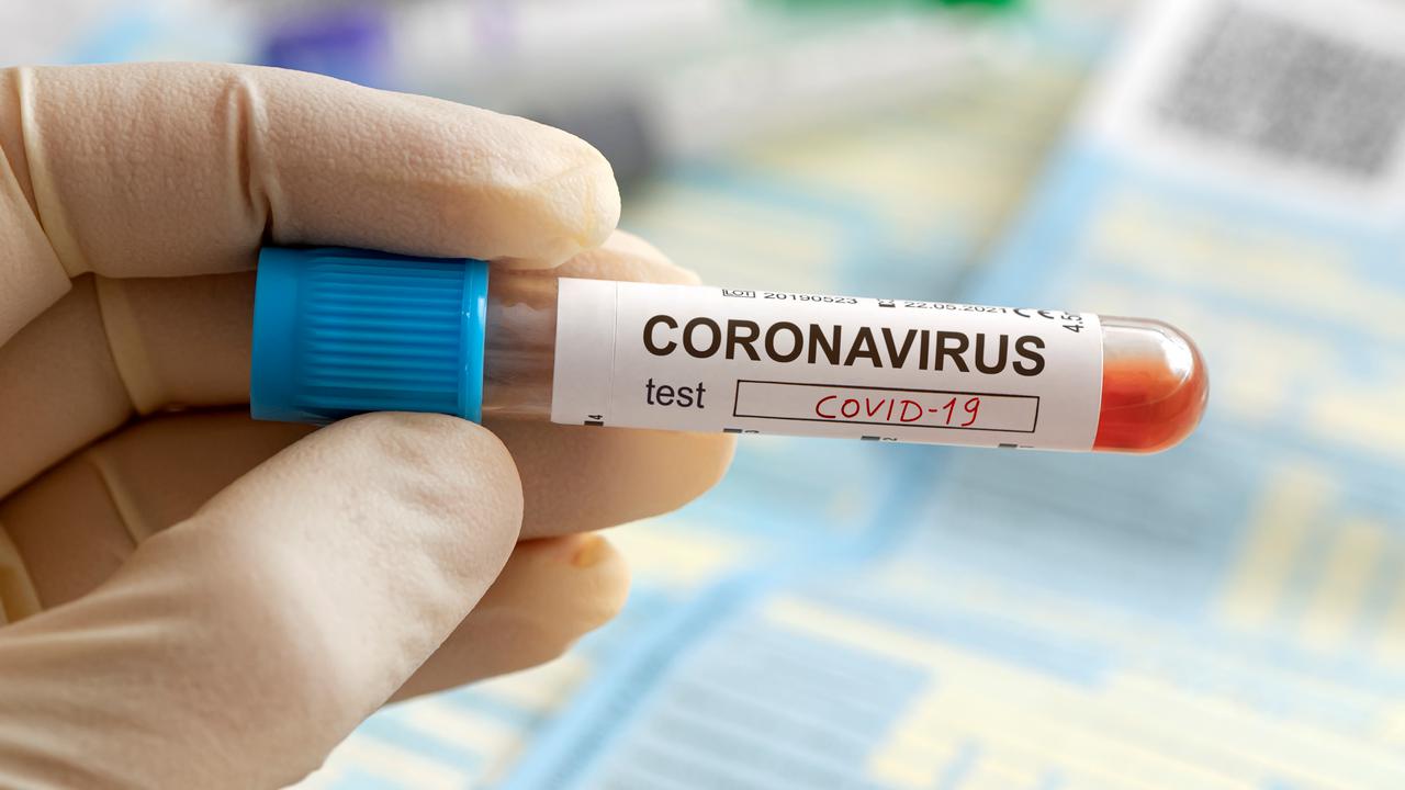 Sjuksköterskas hand som håller ett blodprov som test för coronavirus.