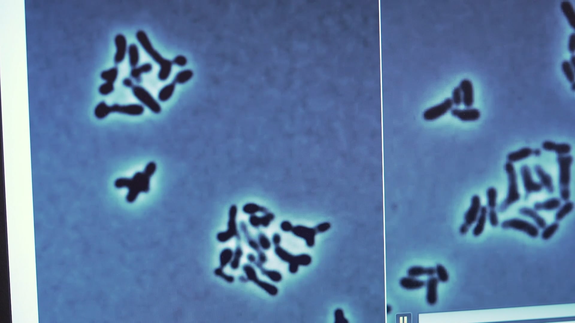 Film: Felipe Cava, professor i infektionsbiologi