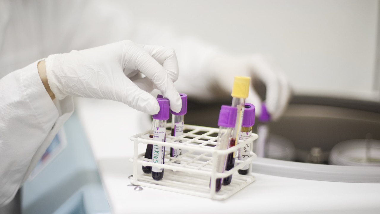 Bild på Kapillärprovtagning