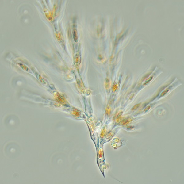 Närbild på plankton.