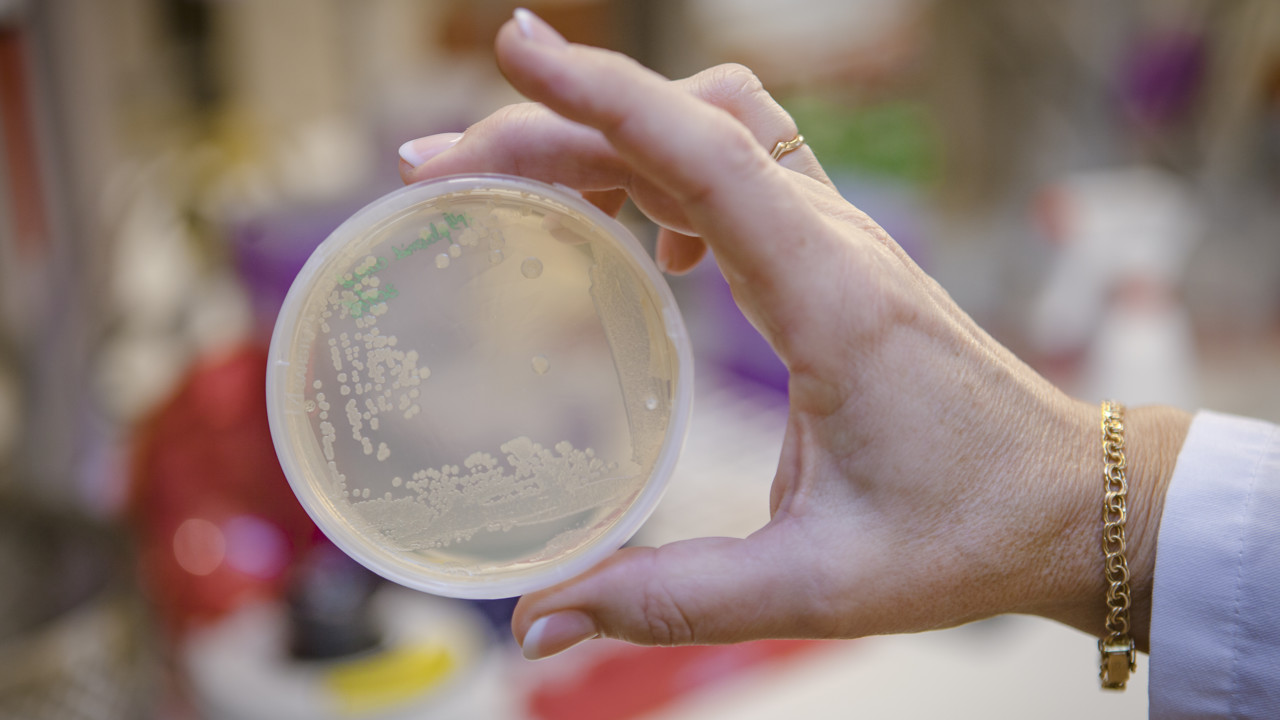 Bild på bakterieodling