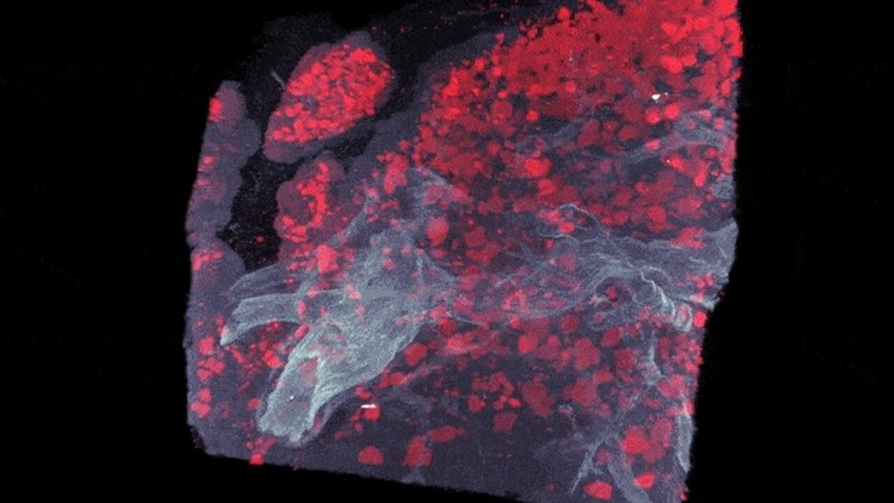 Del av bukspottskörteln