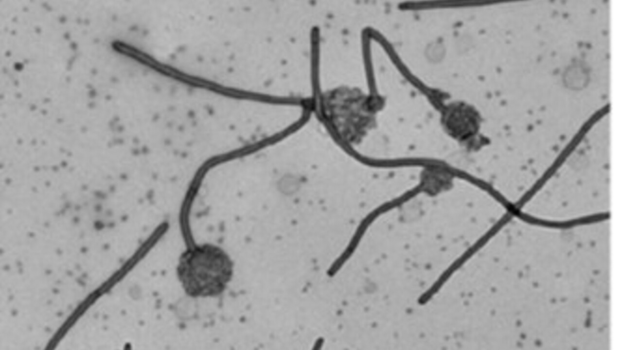 Svartvita streck i mikroskop
