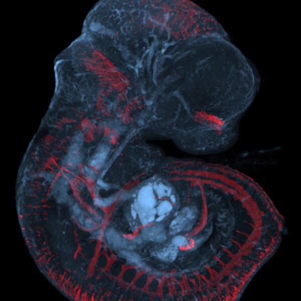 Tomografskärmbild på musfoster