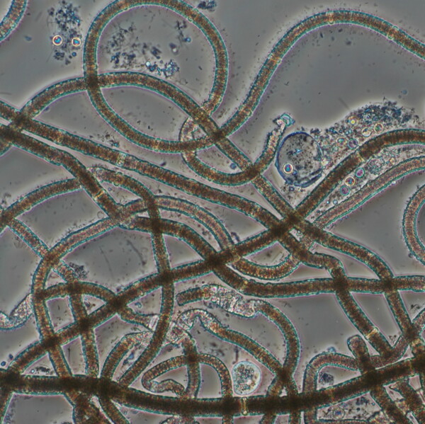Mikroskopbild på cyanobakterien Nodularia spumigena.