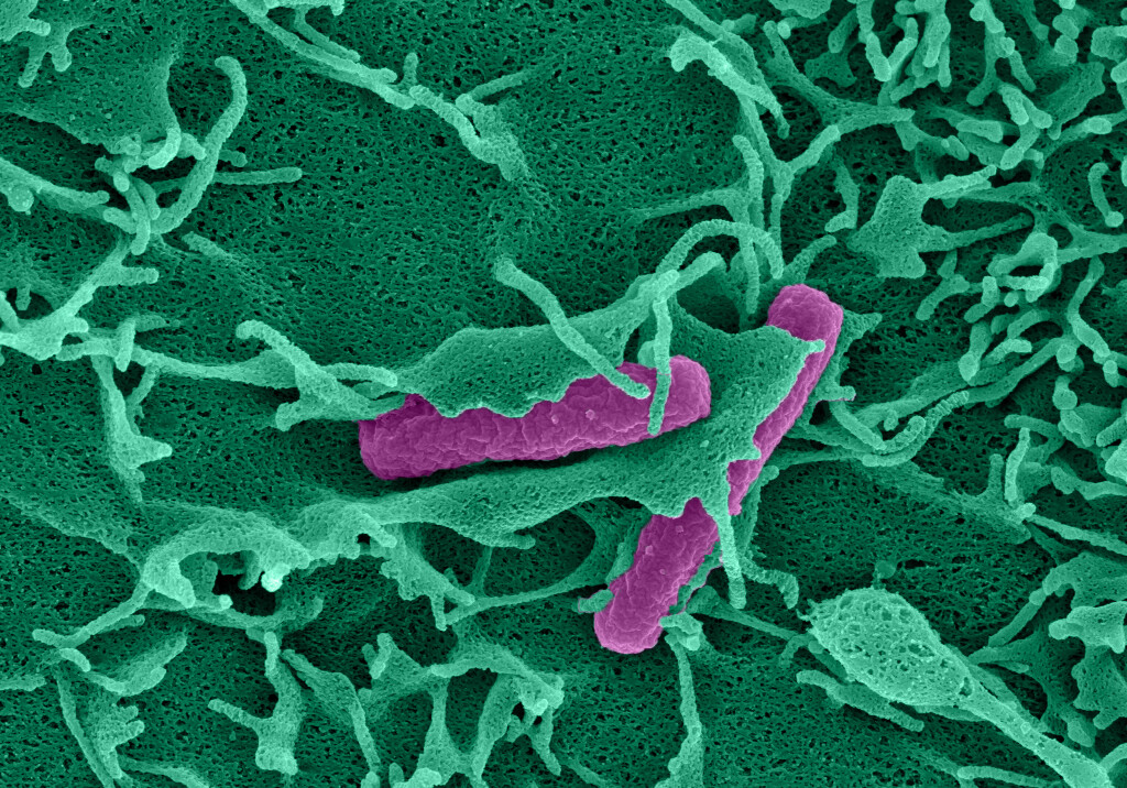 Coloured electron microscopy image of a nascent plasma membrane ruffle enclosing a bacterium which invades an intestinal epithelial cell. Sample: Lalitha Tadala; Image acquisition: Ramón Cervantes-Rivera; Artistic rendering: Atin Sharma. MIMS, Umeå University.