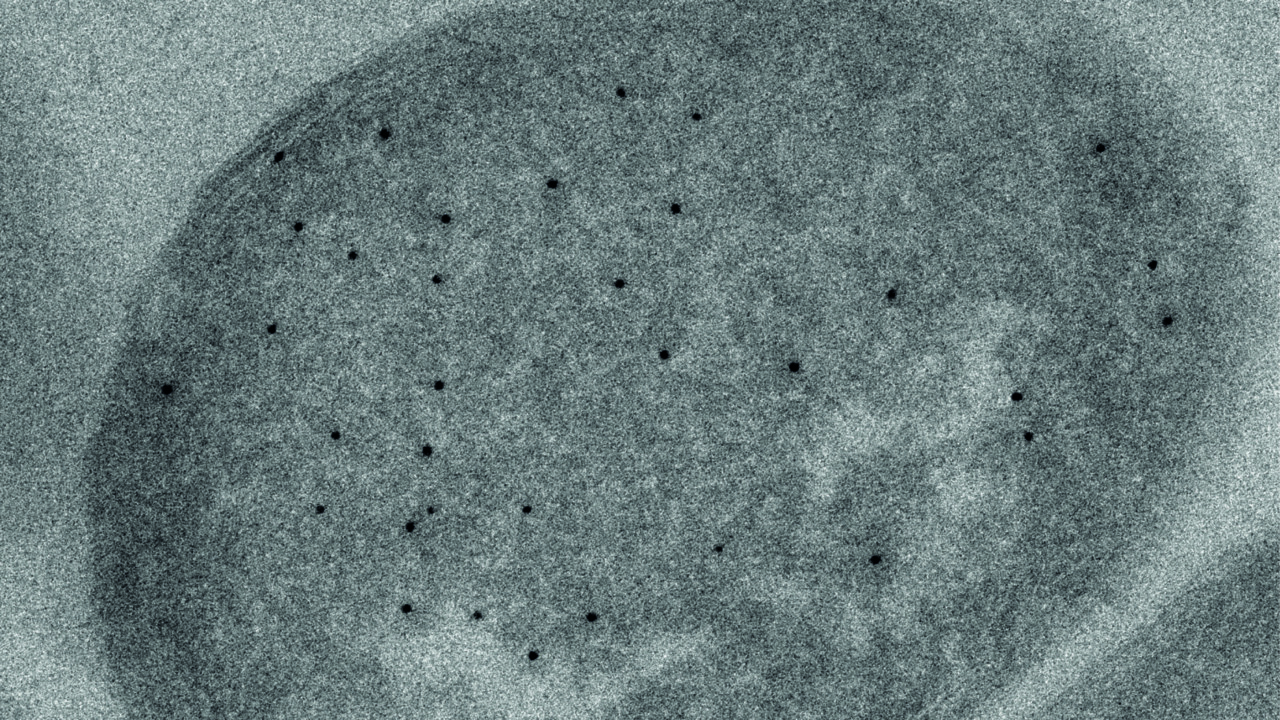 YopN-protein i elektronmikroskop