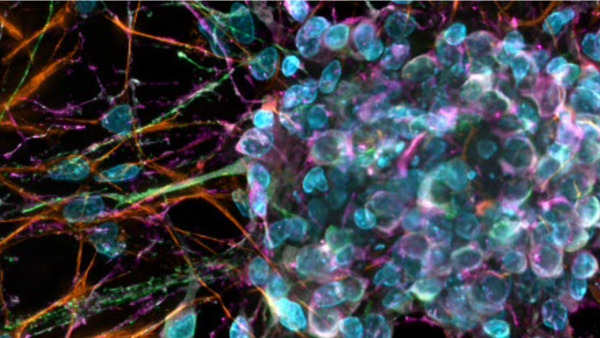 Zeiss Celldiscoverer 7 workshop