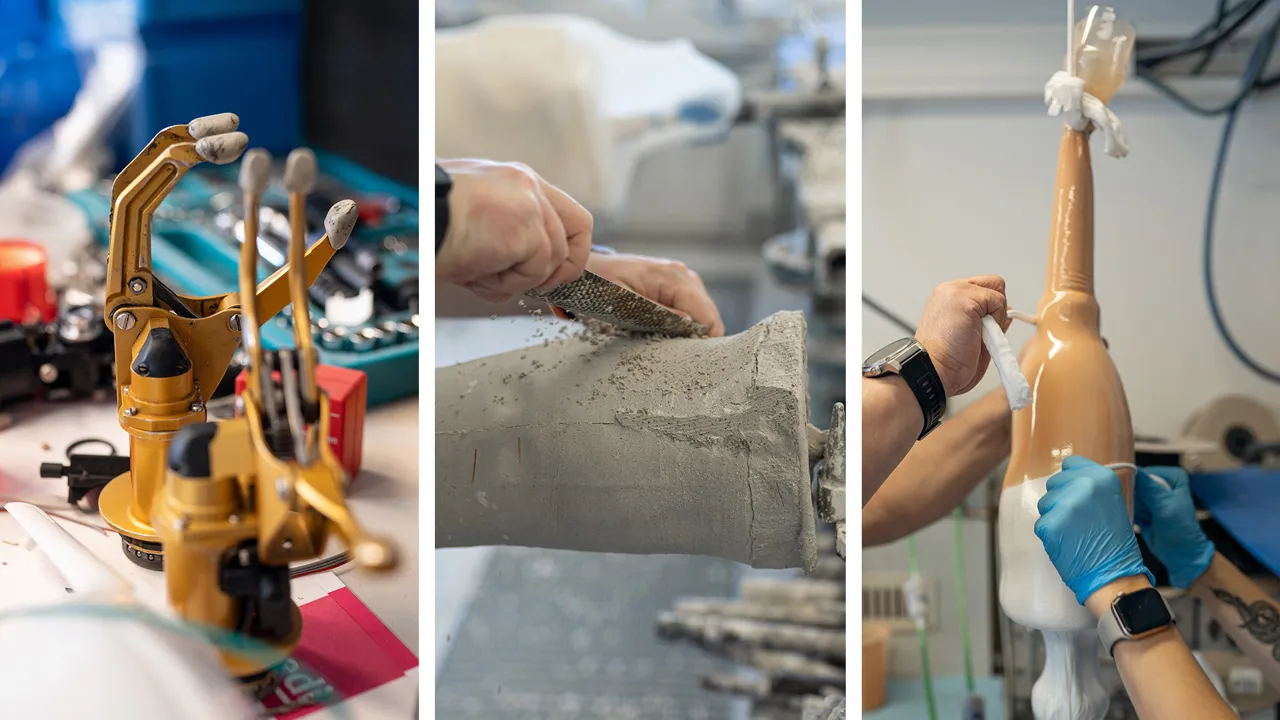 Visiting prosthetists and orthopedic technicians to get a better understanding of the whole process.