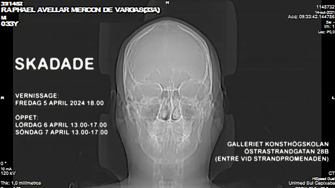 Röntgenbild av mänsklig skalle mot svart bakgrund